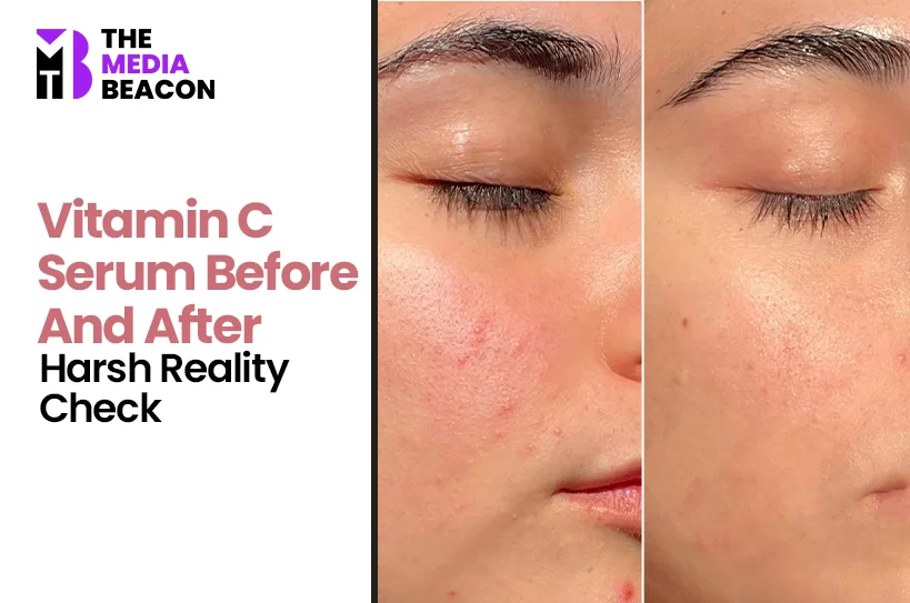 Vitamin C Serum Before and After